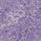 Netrin G2 antibody, NBP2-49653, Novus Biologicals, Immunohistochemistry frozen image 