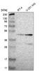 Zinc Finger And SCAN Domain Containing 30 antibody, HPA007289, Atlas Antibodies, Western Blot image 