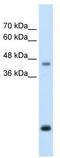 Asporin antibody, TA344139, Origene, Western Blot image 