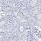 Keratin 1 antibody, HPA017917, Atlas Antibodies, Immunohistochemistry frozen image 