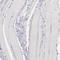 Complement C1q A Chain antibody, HPA002350, Atlas Antibodies, Immunohistochemistry frozen image 