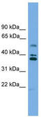 Low Density Lipoprotein Receptor Class A Domain Containing 3 antibody, TA337763, Origene, Western Blot image 