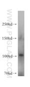 Multiple C2 And Transmembrane Domain Containing 2 antibody, 17578-1-AP, Proteintech Group, Western Blot image 