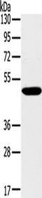 Protein Phosphatase 2 Regulatory Subunit B''Gamma antibody, TA350299, Origene, Western Blot image 