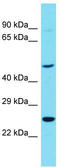Reticulon 4 Receptor Like 1 antibody, TA331557, Origene, Western Blot image 