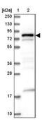 DENN Domain Containing 1C antibody, NBP1-94052, Novus Biologicals, Western Blot image 