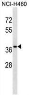 CutC Copper Transporter antibody, AP51140PU-N, Origene, Western Blot image 