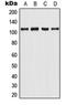 Androgen Receptor antibody, orb213578, Biorbyt, Western Blot image 