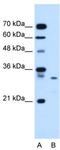 Syndecan Binding Protein antibody, TA336153, Origene, Western Blot image 