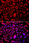Tumor Protein P53 Binding Protein 2 antibody, STJ27671, St John