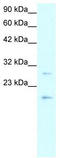 CLDN1 antibody, TA334200, Origene, Western Blot image 