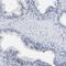 Xin Actin Binding Repeat Containing 1 antibody, HPA016750, Atlas Antibodies, Immunohistochemistry frozen image 