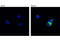 Hematopoietic Cell-Specific Lyn Substrate 1 antibody, 8714T, Cell Signaling Technology, Immunocytochemistry image 