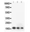 Heparin-binding growth factor 2 antibody, RP1006, Boster Biological Technology, Western Blot image 