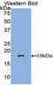 NADH:Ubiquinone Oxidoreductase Subunit AB1 antibody, LS-C292631, Lifespan Biosciences, Western Blot image 