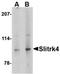 SLIT And NTRK Like Family Member 4 antibody, orb74945, Biorbyt, Western Blot image 
