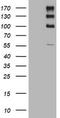 ALK Receptor Tyrosine Kinase antibody, TA801324, Origene, Western Blot image 