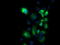 Protein Kinase, Membrane Associated Tyrosine/Threonine 1 antibody, TA500875, Origene, Immunofluorescence image 