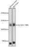 SLC4A4 antibody, GTX54676, GeneTex, Western Blot image 