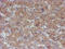 ATR-interacting protein antibody, M03862, Boster Biological Technology, Immunohistochemistry paraffin image 