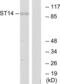 Suppression Of Tumorigenicity 14 antibody, LS-B4906, Lifespan Biosciences, Western Blot image 