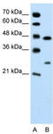 Claudin 18 antibody, TA346056, Origene, Western Blot image 
