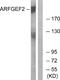 ADP Ribosylation Factor Guanine Nucleotide Exchange Factor 2 antibody, A30581, Boster Biological Technology, Western Blot image 