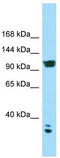 Voltage-dependent calcium channel subunit alpha-2/delta-2 antibody, TA338138, Origene, Western Blot image 