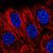 Centromere Protein T antibody, HPA058036, Atlas Antibodies, Immunofluorescence image 