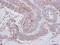 LYN Proto-Oncogene, Src Family Tyrosine Kinase antibody, NBP2-17188, Novus Biologicals, Immunohistochemistry frozen image 