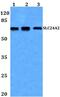 Solute Carrier Family 24 Member 2 antibody, PA5-37224, Invitrogen Antibodies, Western Blot image 