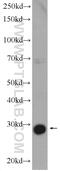 Acetoacetyl-CoA Synthetase antibody, 13815-1-AP, Proteintech Group, Western Blot image 