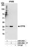 Electron transfer flavoprotein subunit beta antibody, A305-483A, Bethyl Labs, Immunoprecipitation image 