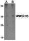 Secernin 3 antibody, PA5-20994, Invitrogen Antibodies, Western Blot image 