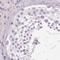 HAD antibody, NBP2-48755, Novus Biologicals, Immunohistochemistry paraffin image 
