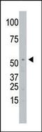 Signal Peptide Peptidase Like 2A antibody, PA5-13337, Invitrogen Antibodies, Western Blot image 
