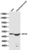 Keratin 20 antibody, LS-B14506, Lifespan Biosciences, Western Blot image 
