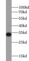 Uridine-Cytidine Kinase 1 antibody, FNab09222, FineTest, Western Blot image 