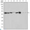 Aurora Kinase A antibody, LS-C812503, Lifespan Biosciences, Enzyme Linked Immunosorbent Assay image 