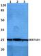 SERTA domain-containing protein 1 antibody, A09983, Boster Biological Technology, Western Blot image 