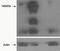 Tankyrase-1 antibody, NBP1-36994, Novus Biologicals, Western Blot image 