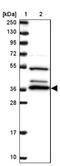 3'(2'), 5'-Bisphosphate Nucleotidase 1 antibody, NBP2-14359, Novus Biologicals, Western Blot image 
