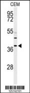 Ribonuclease H2 Subunit B antibody, 61-658, ProSci, Western Blot image 
