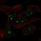 MYCN Proto-Oncogene, BHLH Transcription Factor antibody, NBP2-56178, Novus Biologicals, Immunofluorescence image 
