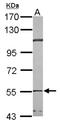 Chaperonin Containing TCP1 Subunit 2 antibody, NBP2-20586, Novus Biologicals, Western Blot image 