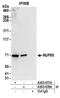 Nucleoporin 85 antibody, A303-978A, Bethyl Labs, Immunoprecipitation image 