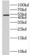 Solute Carrier Family 44 Member 1 antibody, FNab07964, FineTest, Western Blot image 