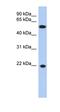 LOC100361560 antibody, orb325688, Biorbyt, Western Blot image 