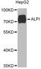 Intestinal-type alkaline phosphatase antibody, A6226, ABclonal Technology, Western Blot image 