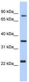 Putative uncharacterized protein C17orf82 antibody, TA333319, Origene, Western Blot image 
